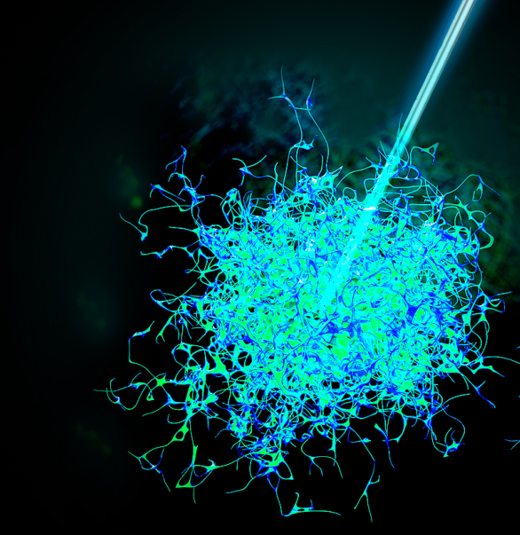 今天，我們把腫瘤的內(nèi)部「融穿」了