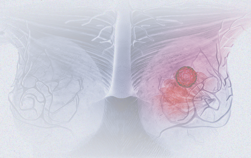 國際婦女節(jié) | 關(guān)注乳腺癌 微創(chuàng)介入讓美麗繼續(xù)，「乳」愿以償正成為現(xiàn)實(shí)