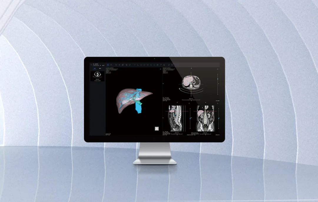 北京市首款！海杰亞醫(yī)療自主研發(fā)的AI+肝臟CT影像處理軟件獲批上市！
